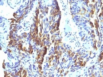 Melanoma Antibody (clone KBA.62, Ready-to-Use)