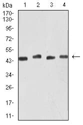 KRT19 / CK19 / Cytokeratin 19 Antibody (clone 8H1A8)