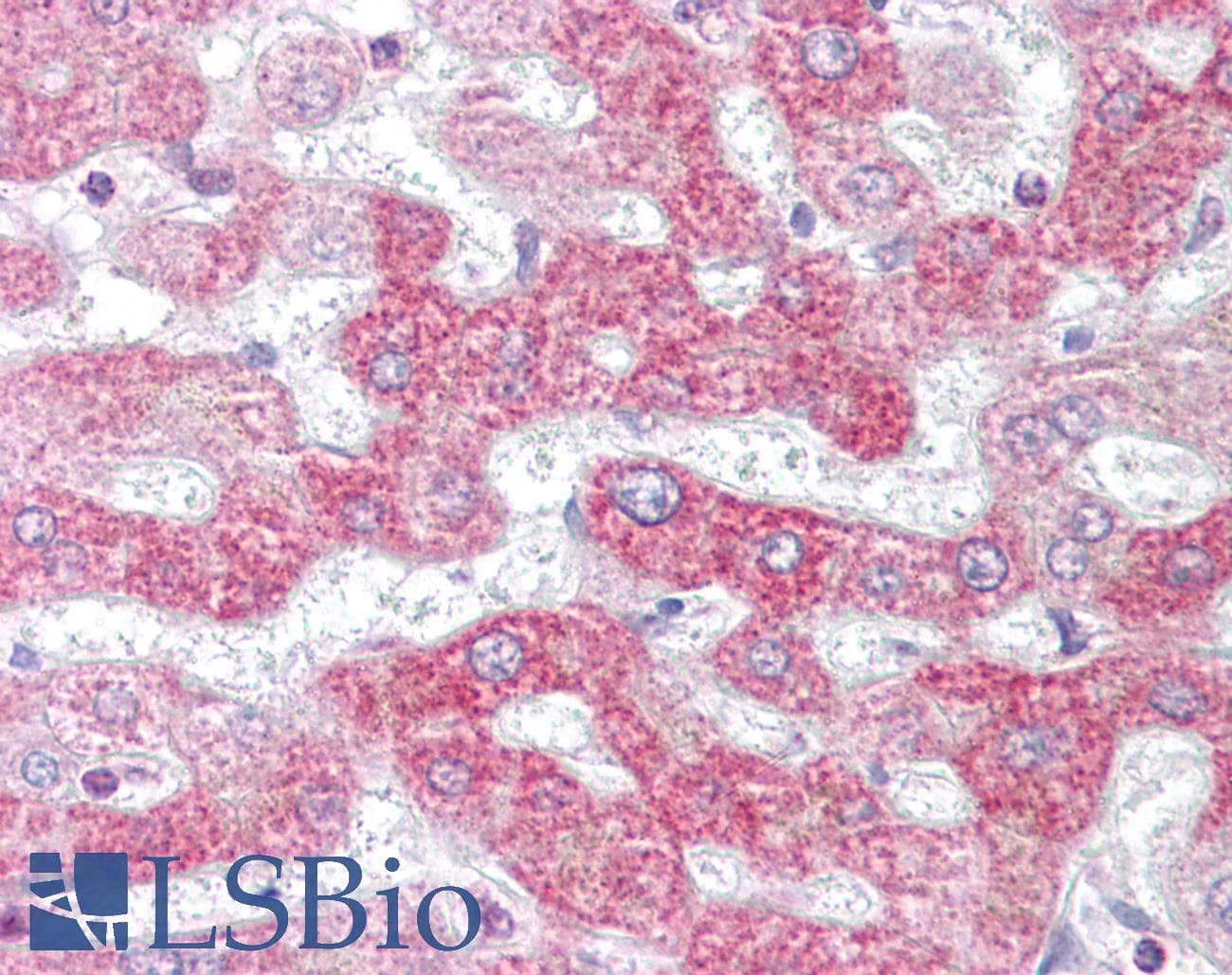 IHC-plus™ PHB / Prohibitin Antibody (aa92-121)