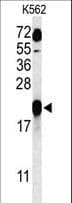 IHC-plus™ GAGE7 Antibody (aa87-116)