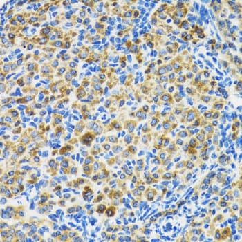 Polyclonal Rabbit anti-Human HSPA9 / Mortalin / GRP75 Antibody (IHC, IF, WB)