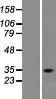 Human FAM57B Protein (Over-Expression Lysate Myc-DDK (Flag))