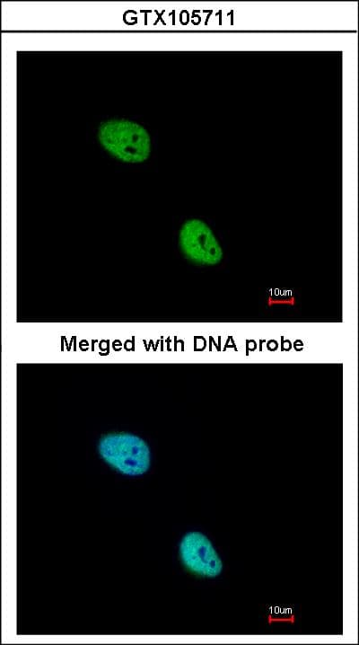 Polyclonal Rabbit anti-Human NKX2-5 Antibody (aa1-218, WB)