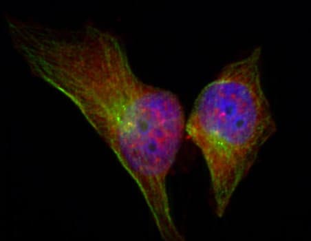 HSPB1 / HSP27 Antibody (phospho-Ser78)