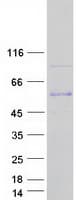 Human CAMK2B / CaMKII Beta Protein (Recombinant Myc-DDK (Flag))