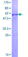 Human GSC / Goosecoid Protein (Recombinant GST)