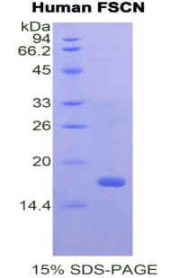 Human FSCN1 / Fascin Protein (Recombinant His)