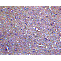 Mitofusin 2 / MFN2 Antibody
