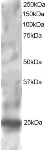 IHC-plus™ RGS1 Antibody (aa198-209)