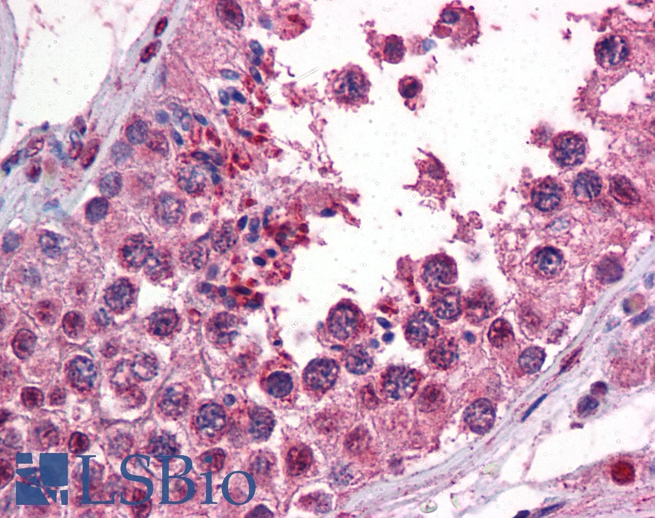 IHC-plus™ Monoclonal Mouse anti-Human CAMK2B / CaMKII Beta Antibody (clone S11, IHC, WB)