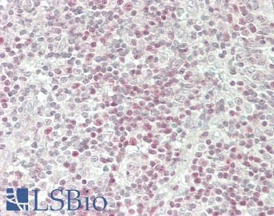 IHC-plus™ BCL11B Antibody (aa850-C-term)