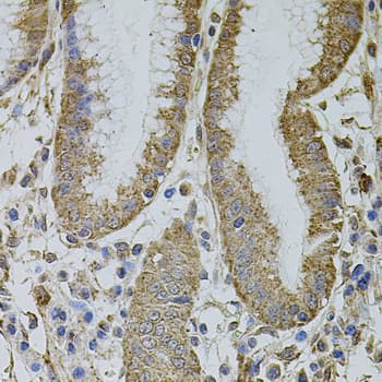 Polyclonal Rabbit anti-Human IF3mt / MTIF3 Antibody (IHC, WB)
