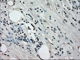 CRYAB / Alpha B Crystallin Antibody (clone OTI3C2)