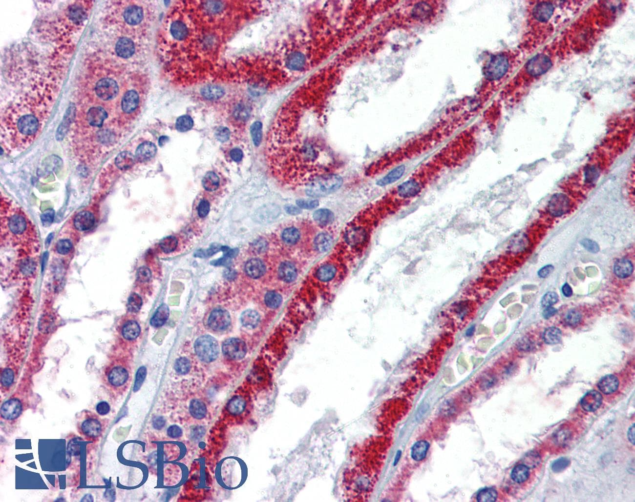 Polyclonal Rabbit anti-Human ATP1B1 Antibody (aa201-250, IHC, WB)