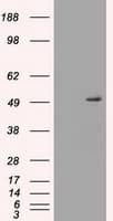 IHC-plus™ SERPINA1 / Alpha 1 Antitrypsin Antibody (clone 15H10)
