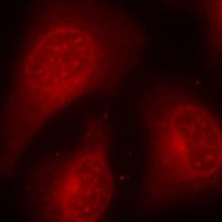 HDAC8 Antibody (phospho-Ser39)
