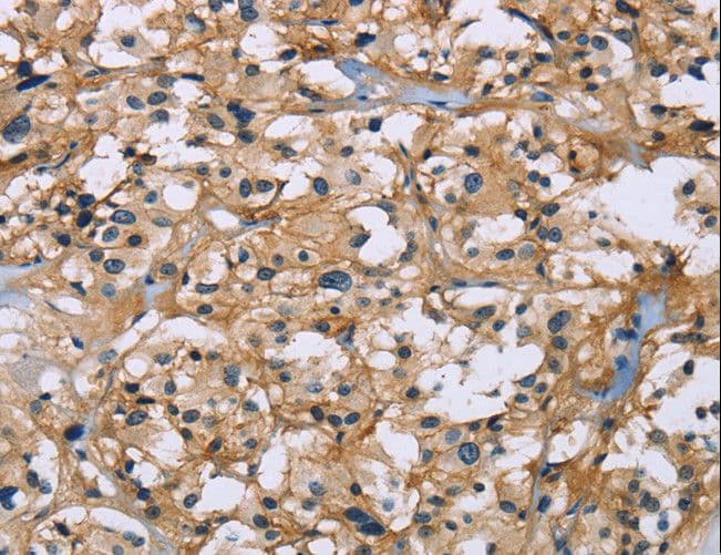 Basigin / Emmprin / CD147 Antibody