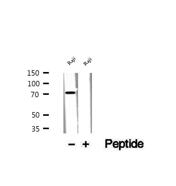 TCAB1 / WDR79 Antibody