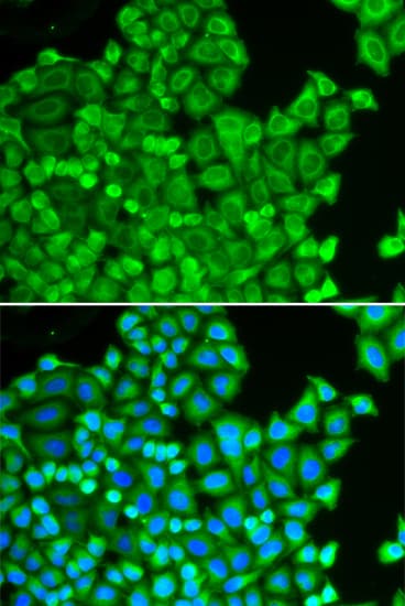 Polyclonal Rabbit anti-Human CSRP1 Antibody (IHC, IF, WB)