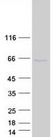 Human ZFYVE19 Protein (Recombinant Myc-DDK (Flag))