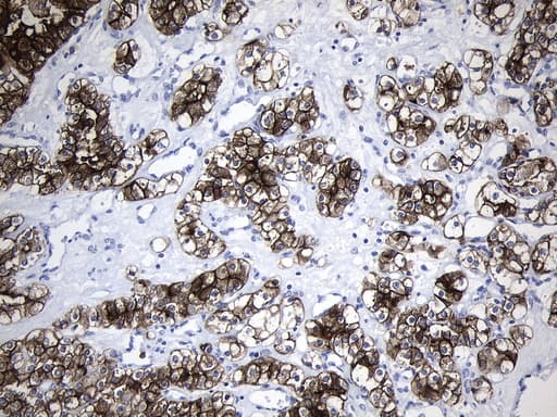 MME / CD10 Antibody (aa411-750, clone UMAB235)