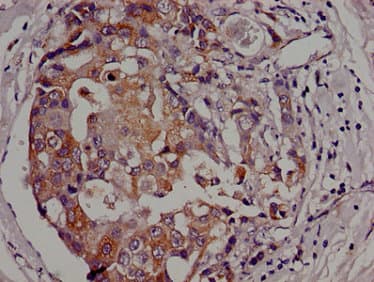 Polyclonal Rabbit anti-Human AK3 / Adenylate Kinase 3 Antibody (IHC)