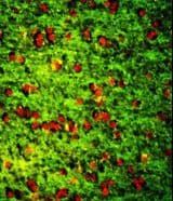 Polyclonal Rabbit anti-Human Dermatopontin / DPT Antibody (aa102-128, IHC, IF, WB)