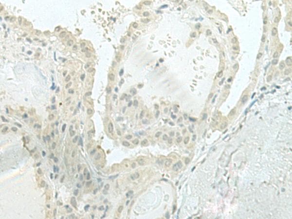 XTP4 / C17orf37 Antibody