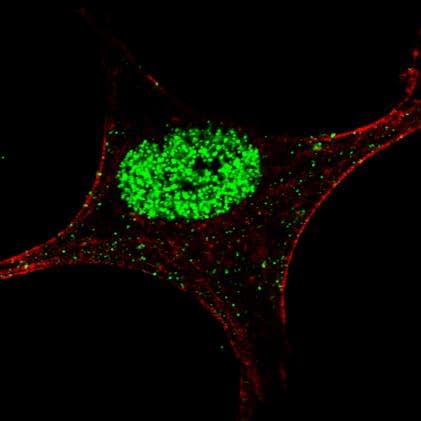 STAT5A Antibody (phospho-Tyr694)