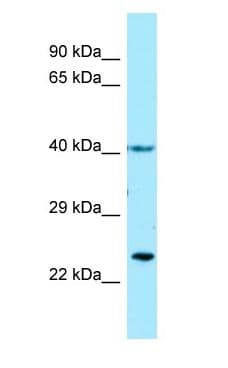 Thromboxane A2 Receptor Antibody (aa37-86)