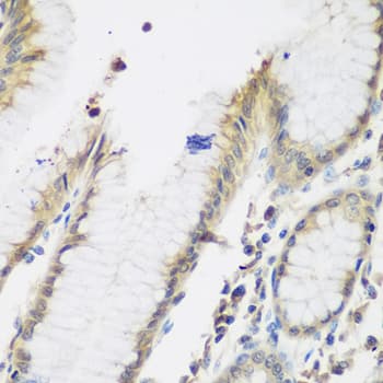 NAA50 / NAT13 / SAN Antibody