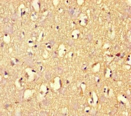 Polyclonal Rabbit anti-Human ARHGAP42 Antibody (IHC, WB)