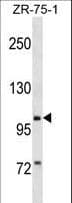 Polyclonal Rabbit anti-Human PIWIL2 Antibody (aa90-119, WB)