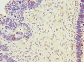 SAP30BP / HTRG Antibody