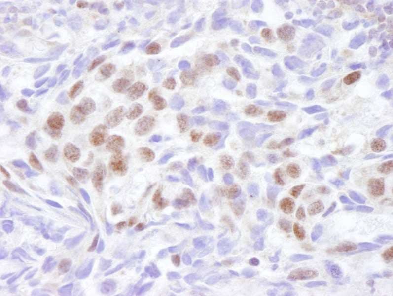 Polyclonal Rabbit anti-Human UBR5 Antibody (aa600-650, IHC)