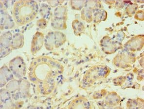 TRPM2 Antibody (aa1204-1503)