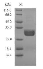 Penicillium citrinum Nuclease P1 Protein (Recombinant 6His, N-terminus)