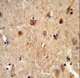 Carboxylesterase 5A / CES5A Antibody (aa244-270)