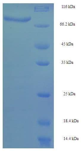 Human CYP4F11 Protein (Recombinant His-SUMO)