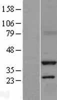 SRR / Serine Racemase Protein (Over-Expression Lysate Myc-DDK (Flag))