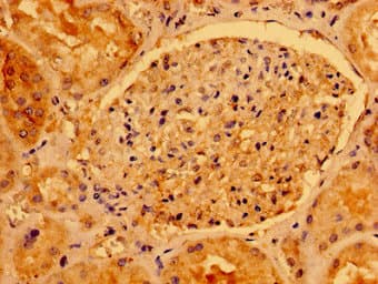 Polyclonal Rabbit anti-Human AACS Antibody (IHC, WB)