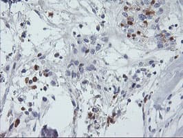 SDS Antibody (clone OTI2C11)
