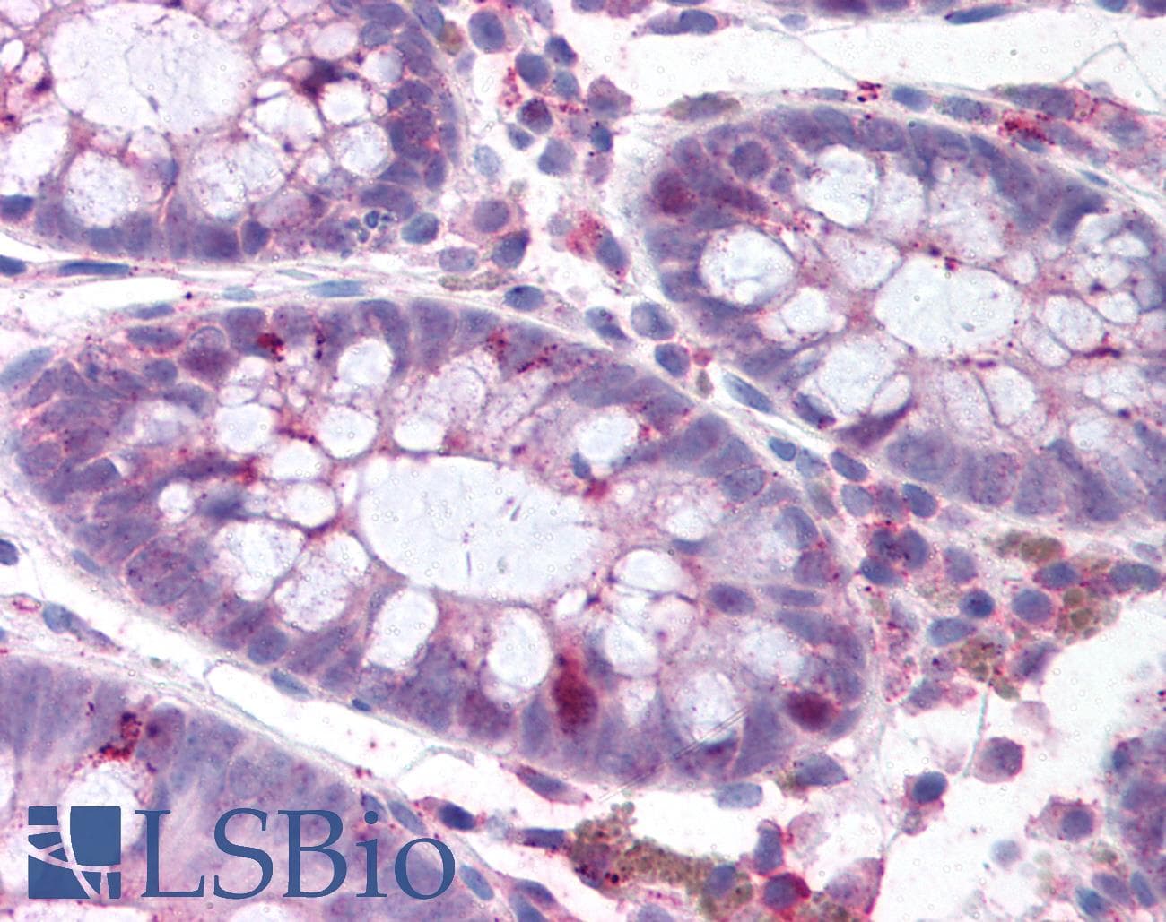 IHC-plus™ PLK1 / PLK-1 Antibody (phospho-Thr210, clone 2A3)