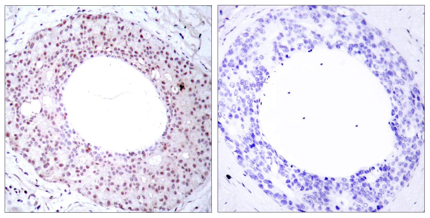 RELA / NFKB p65 Antibody (phospho-Thr254)