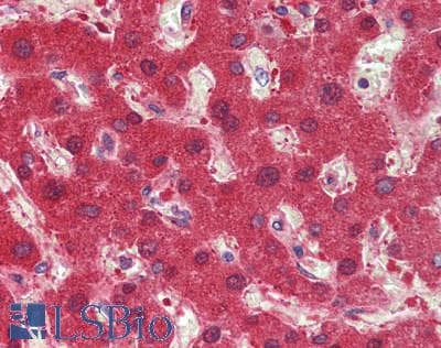 IHC-plus™ Polyclonal Rabbit anti-Human HNF1A / HNF1 Antibody (aa550-600, IHC, WB)