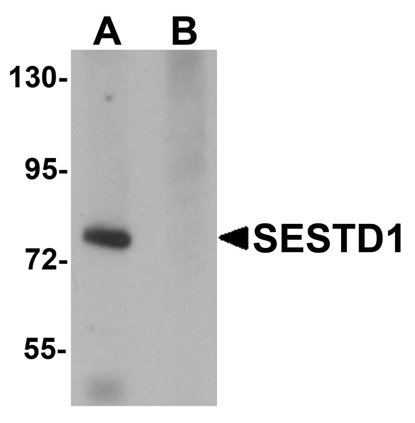 IHC-plus™ SOLO / SESTD1 Antibody
