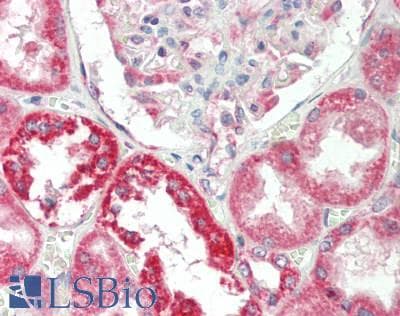 IHC-plus™ Polyclonal Rabbit anti-Human TOMM20 Antibody (IHC, IF, WB)