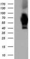 AK5 / Adenylate Kinase 5 Antibody (clone OTI2F9)