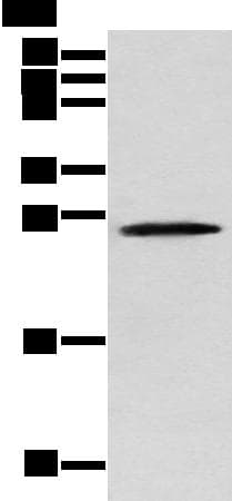 TPPP Antibody