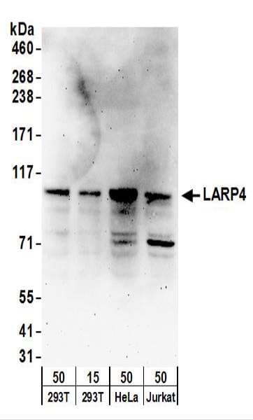 LARP4 Antibody (aa450-500)